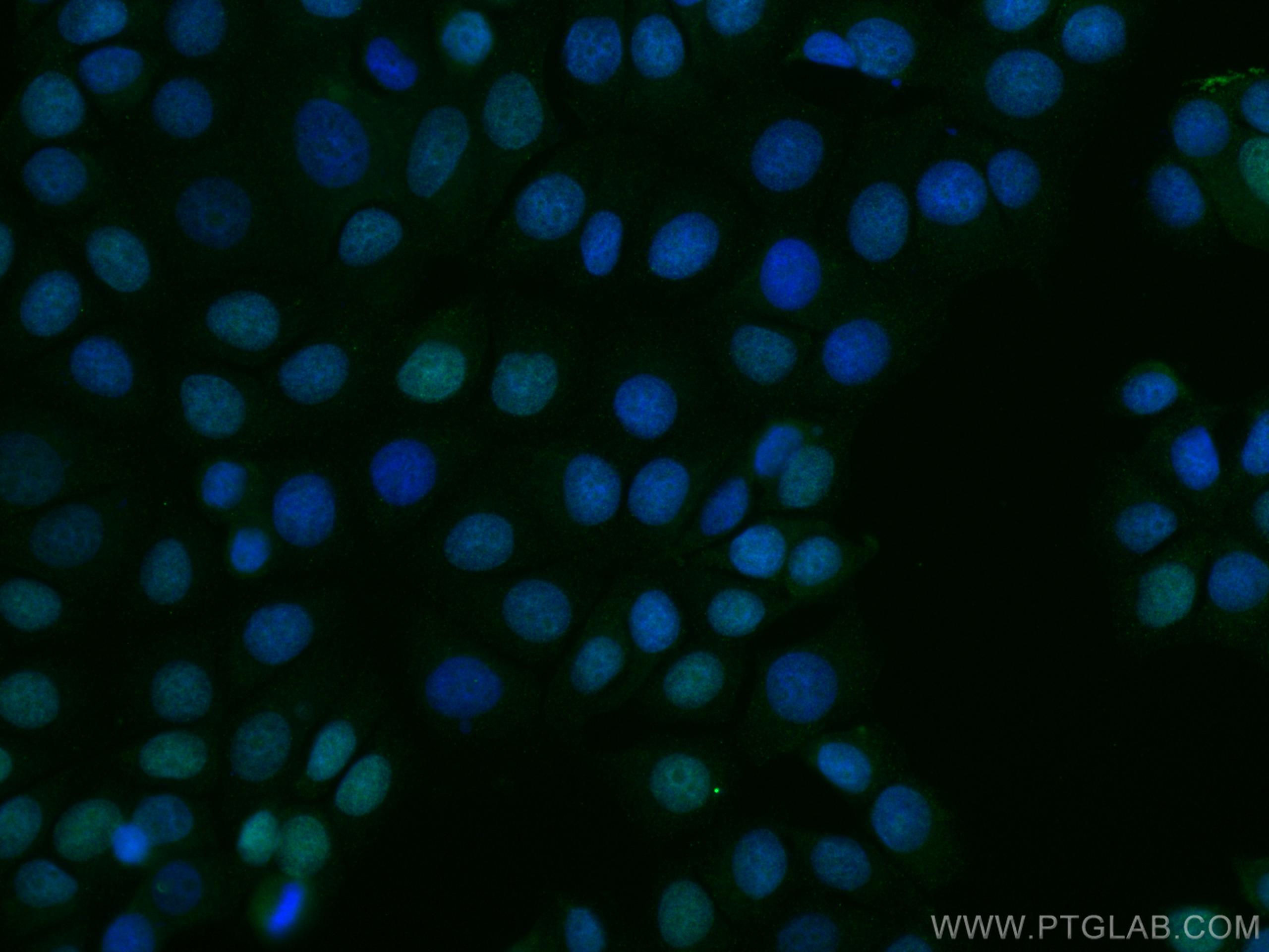 Immunofluorescence (IF) / fluorescent staining of MCF-7 cells using MCM2 Monoclonal antibody (66204-1-Ig)
