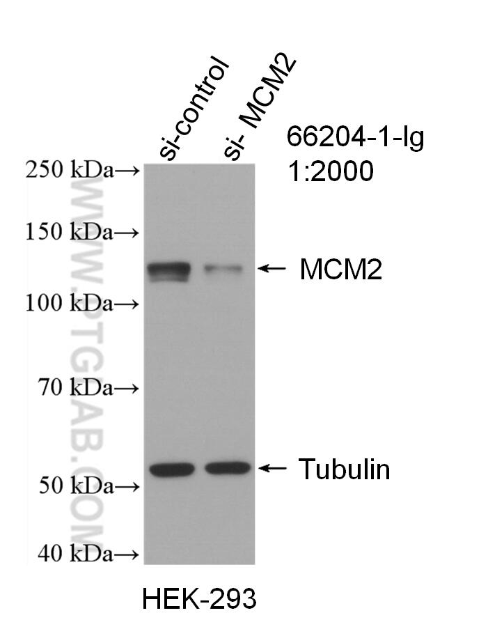 Western Blot (WB) analysis of HEK-293 cells using MCM2 Monoclonal antibody (66204-1-Ig)