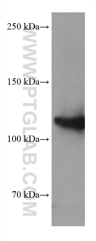 Western Blot (WB) analysis of A431 cells using MCM2 Monoclonal antibody (66204-1-Ig)