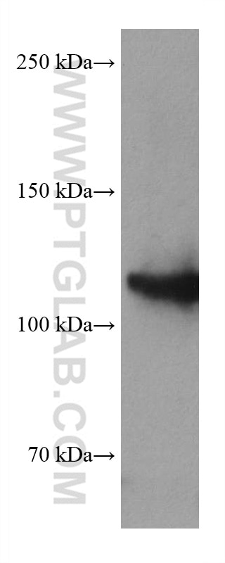 WB analysis of A431 using 66204-1-Ig