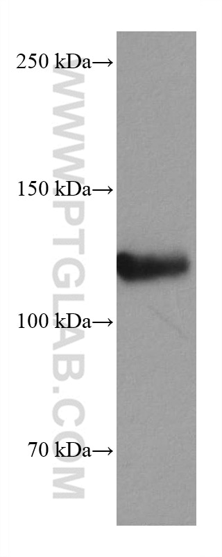 Western Blot (WB) analysis of 4T1 cells using MCM2 Monoclonal antibody (66204-1-Ig)