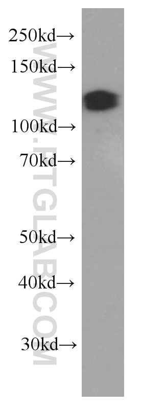 Western Blot (WB) analysis of K-562 cells using MCM2 Monoclonal antibody (66204-1-Ig)