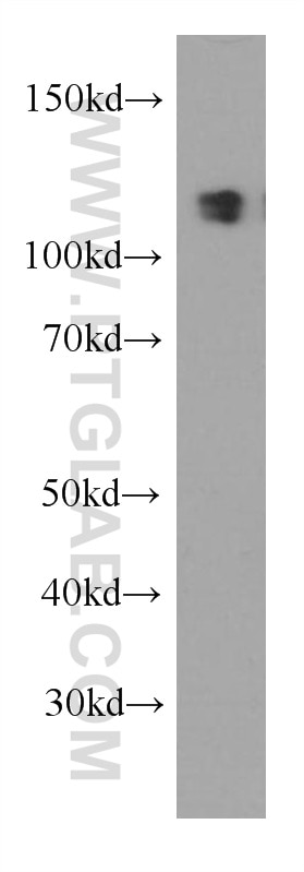 Western Blot (WB) analysis of HEK-293 cells using MCM2 Monoclonal antibody (66204-1-Ig)