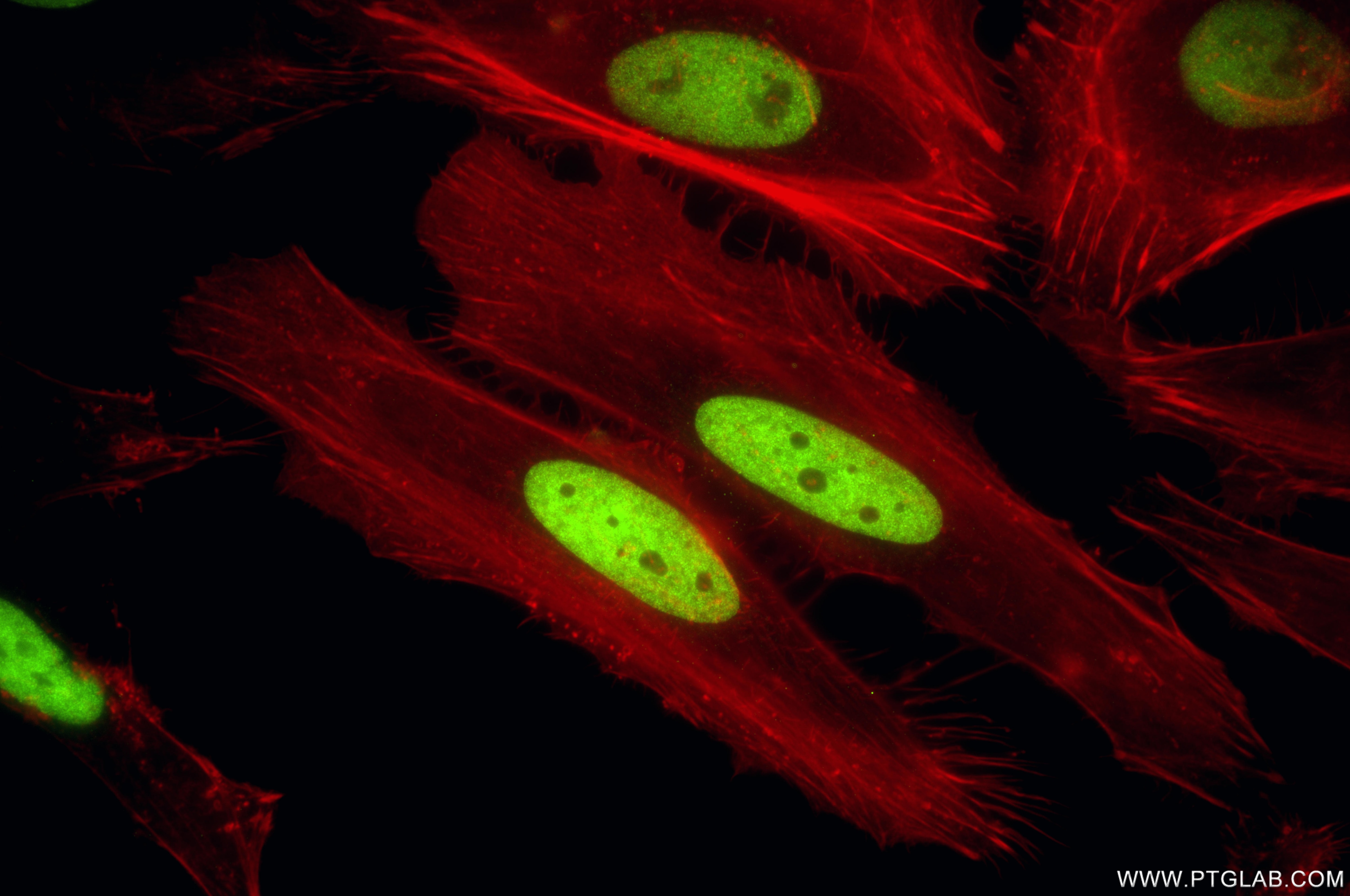 Immunofluorescent analysis of (4% PFA) fixed HeLa cells using MCM2 antibody (84511-2-RR, Clone: 241968D3 ) at dilution of 1:1000 and CoraLite®488-Conjugated Goat Anti-Rabbit IgG(H+L) (SA00013-2), CL594-Phalloidin (red). Immunofluorescence (IF) / fluorescent staining of HeLa cells using MCM2 Recombinant monoclonal antibody (84511-2-RR)