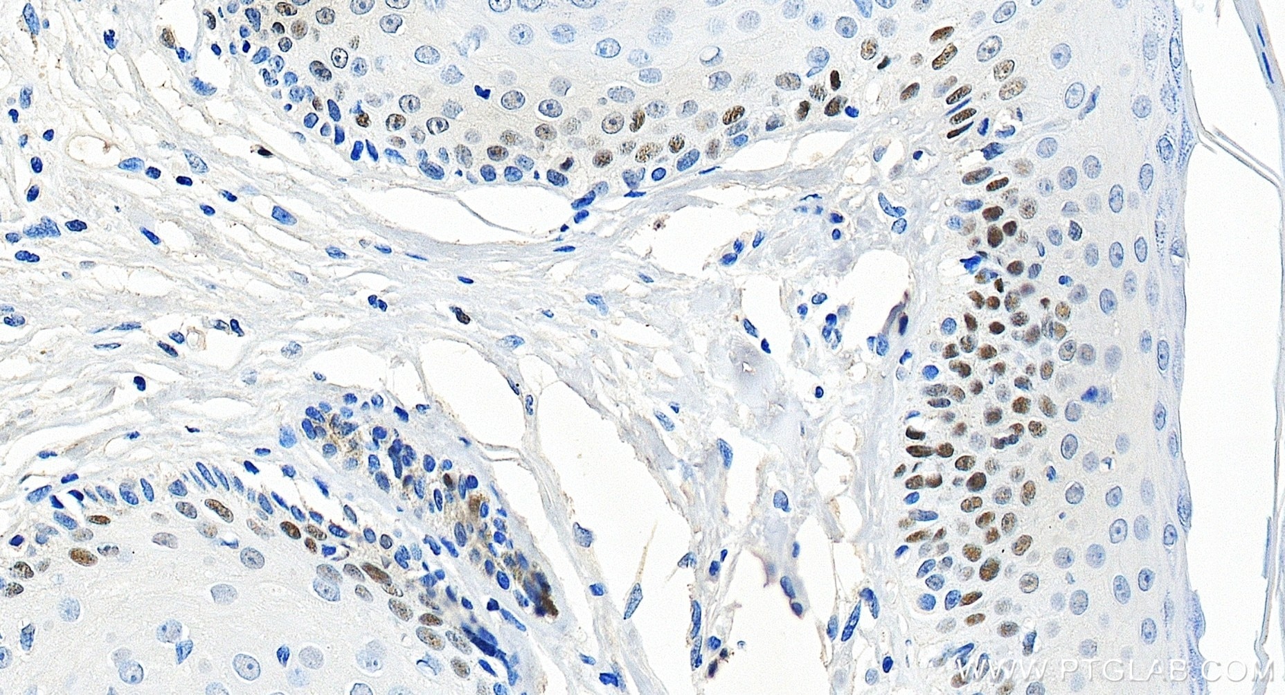 Immunohistochemical analysis of paraffin-embedded human skin tissue slide using 84511-5-RR (MCM2 antibody) at dilution of 1:2000 (under 20x lens). Heat mediated antigen retrieval with Tris-EDTA buffer (pH 9.0). Immunohistochemistry (IHC) staining of human skin tissue using MCM2 Recombinant monoclonal antibody (84511-5-RR)