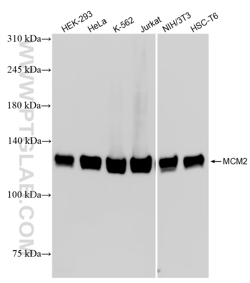 Various lysates were subjected to SDS PAGE followed by western blot with 84511-5-RR (MCM2 antibody) at dilution of 1:10000 incubated at room temperature for 1.5 hours. Western Blot (WB) analysis of various lysates using MCM2 Recombinant monoclonal antibody (84511-5-RR)