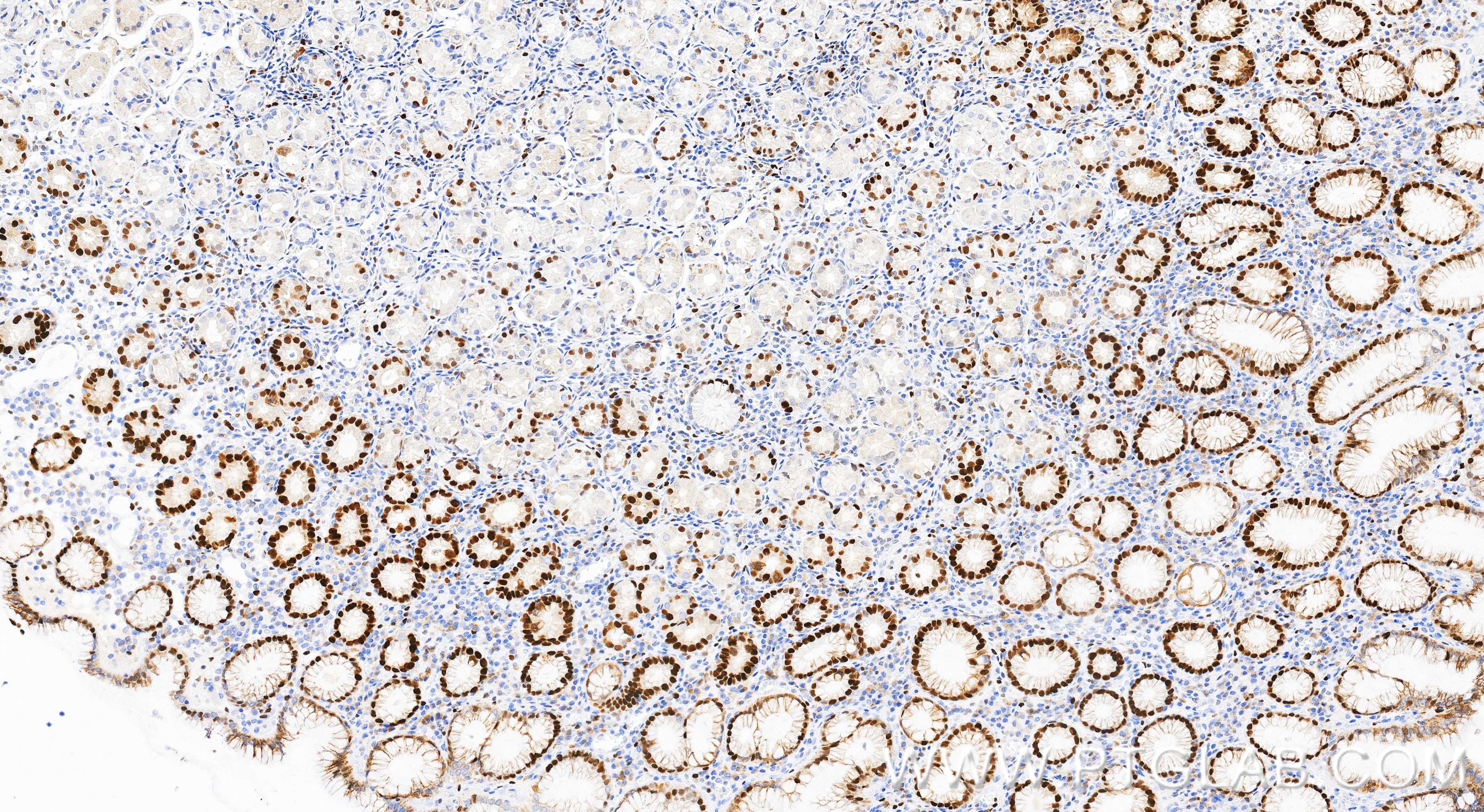 IHC staining of human stomach using 84511-9-RR (same clone as 84511-9-PBS) Immunohistochemistry (IHC) staining of human stomach tissue using MCM2 Recombinant monoclonal antibody (84511-9-RR)
