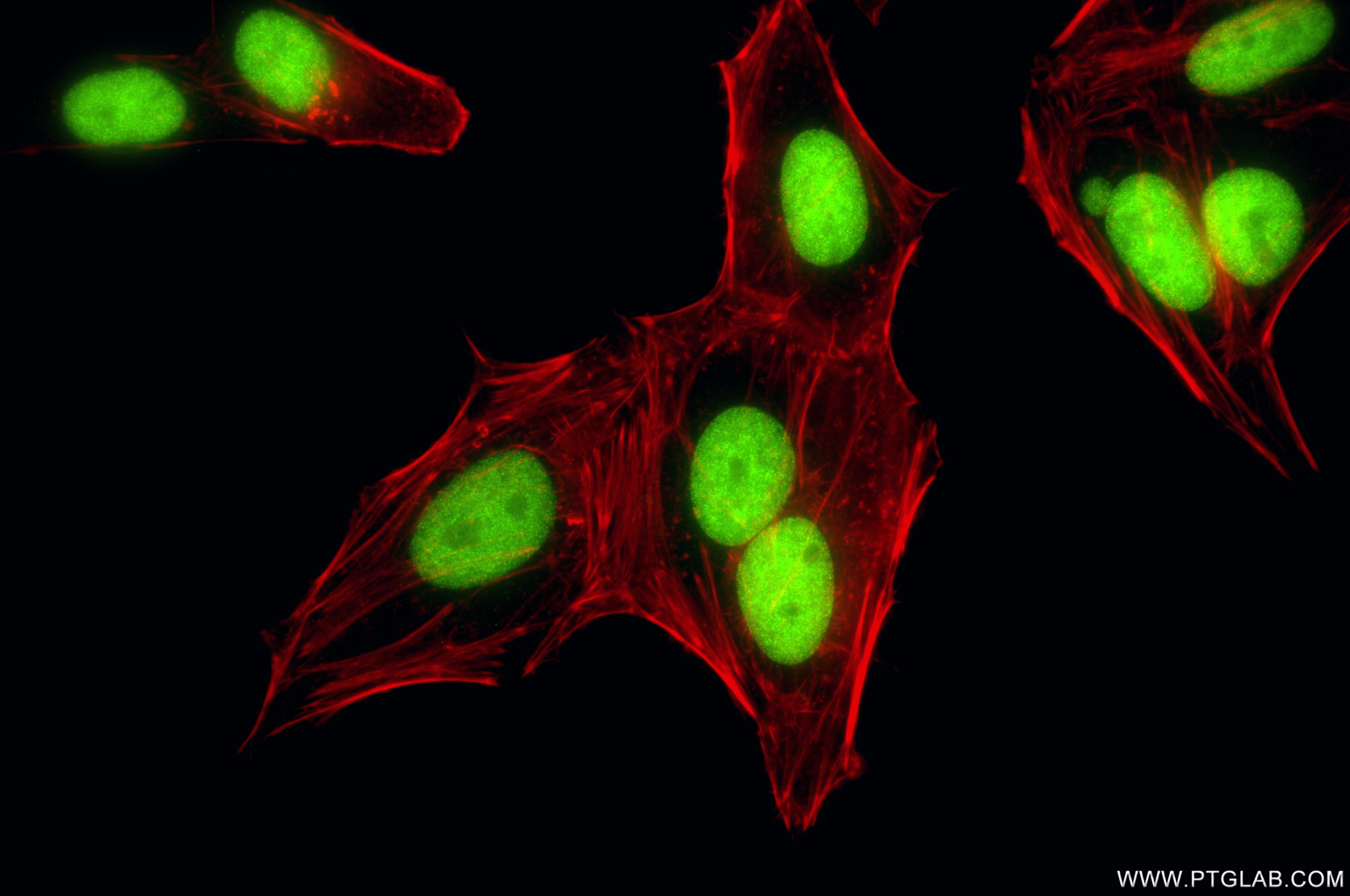 IF Staining of HepG2 using 84511-9-RR (same clone as 84511-9-PBS) Immunofluorescence (IF) / fluorescent staining of HepG2 cells using MCM2 Recombinant monoclonal antibody (84511-9-RR)
