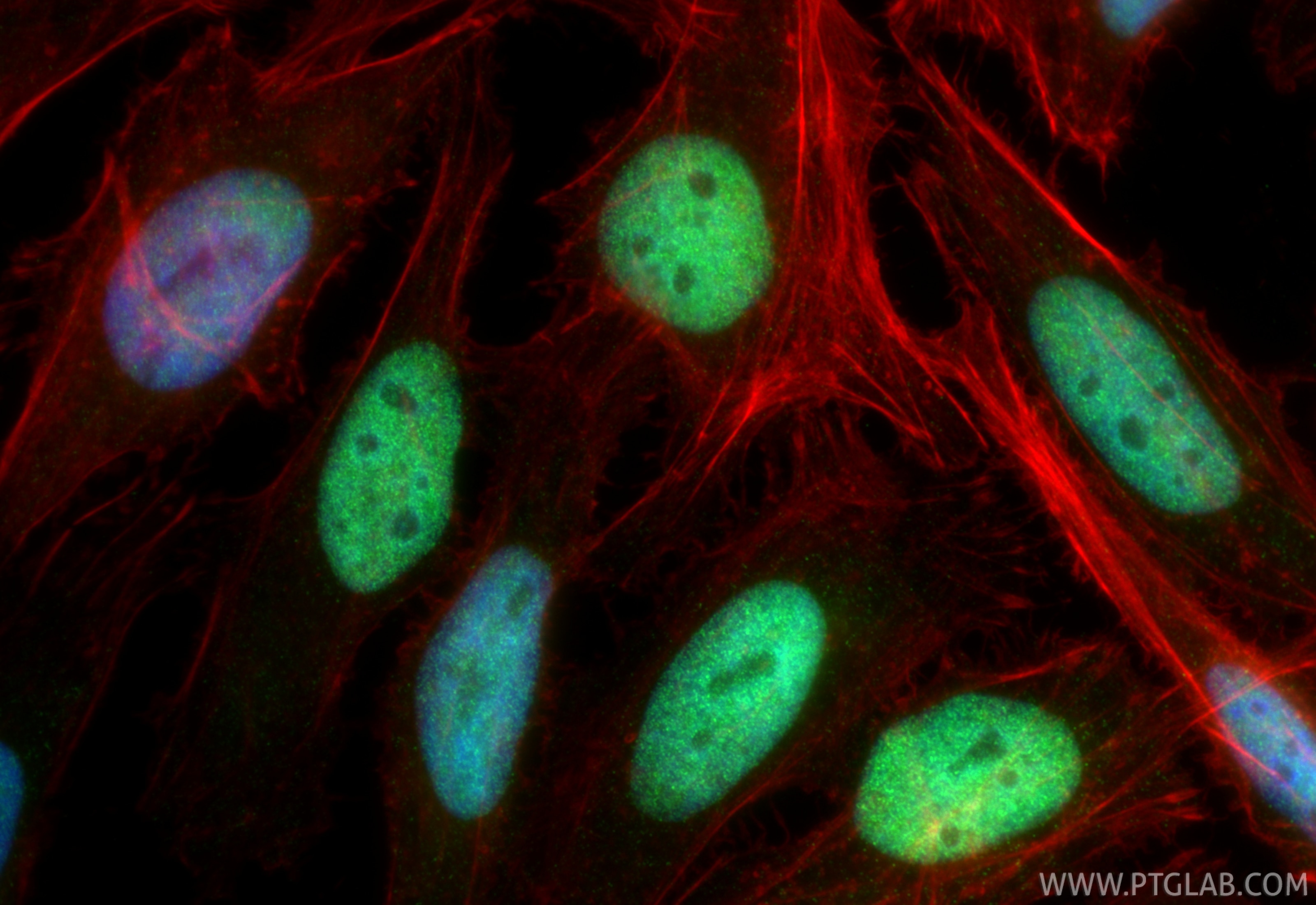 IF Staining of HeLa using 84511-9-RR (same clone as 84511-9-PBS) Immunofluorescence (IF) / fluorescent staining of HeLa cells using MCM2 Recombinant monoclonal antibody (84511-9-RR)