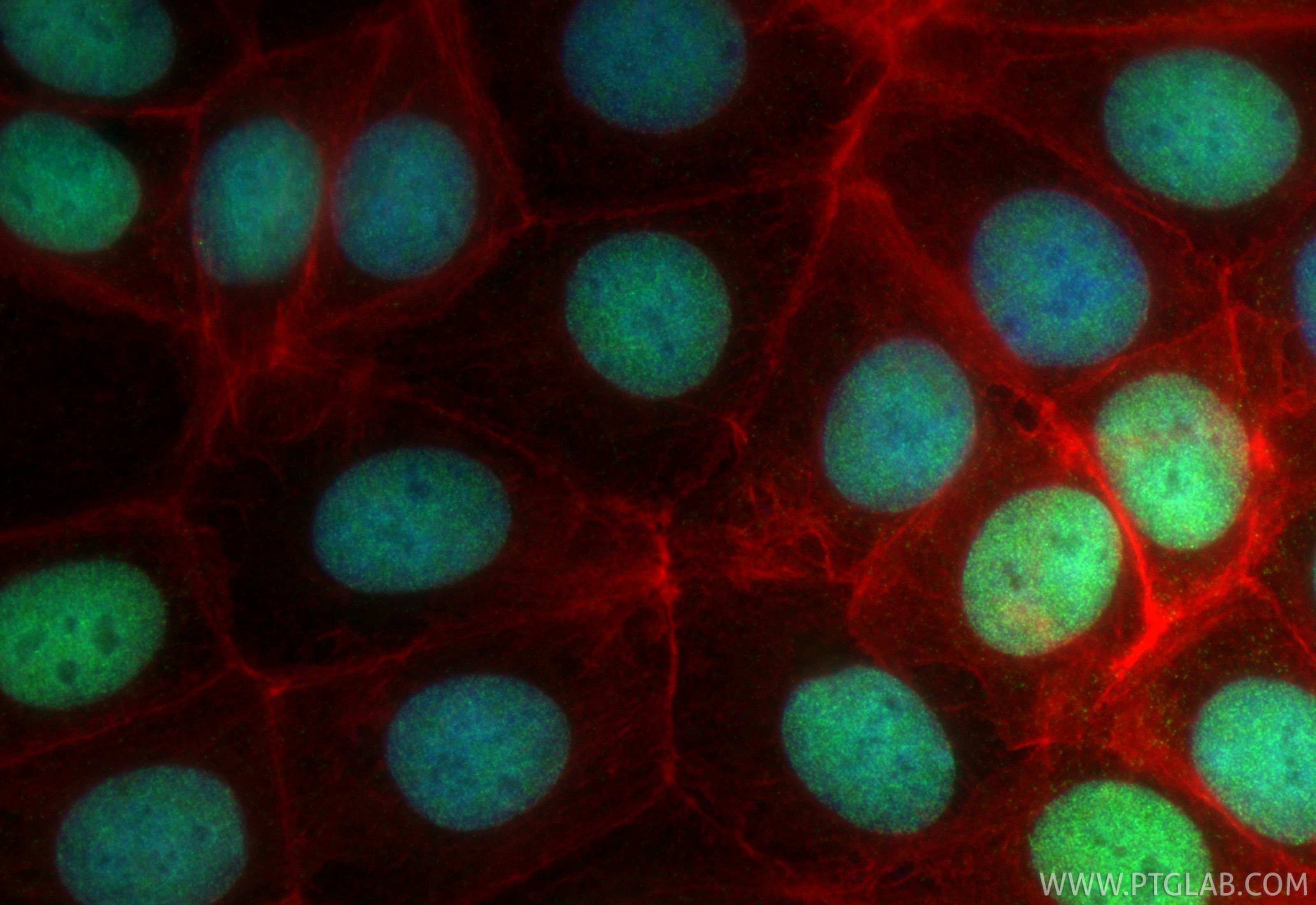 IF Staining of MCF-7 using 84511-9-RR (same clone as 84511-9-PBS) Immunofluorescence (IF) / fluorescent staining of MCF-7 cells using MCM2 Recombinant monoclonal antibody (84511-9-RR)