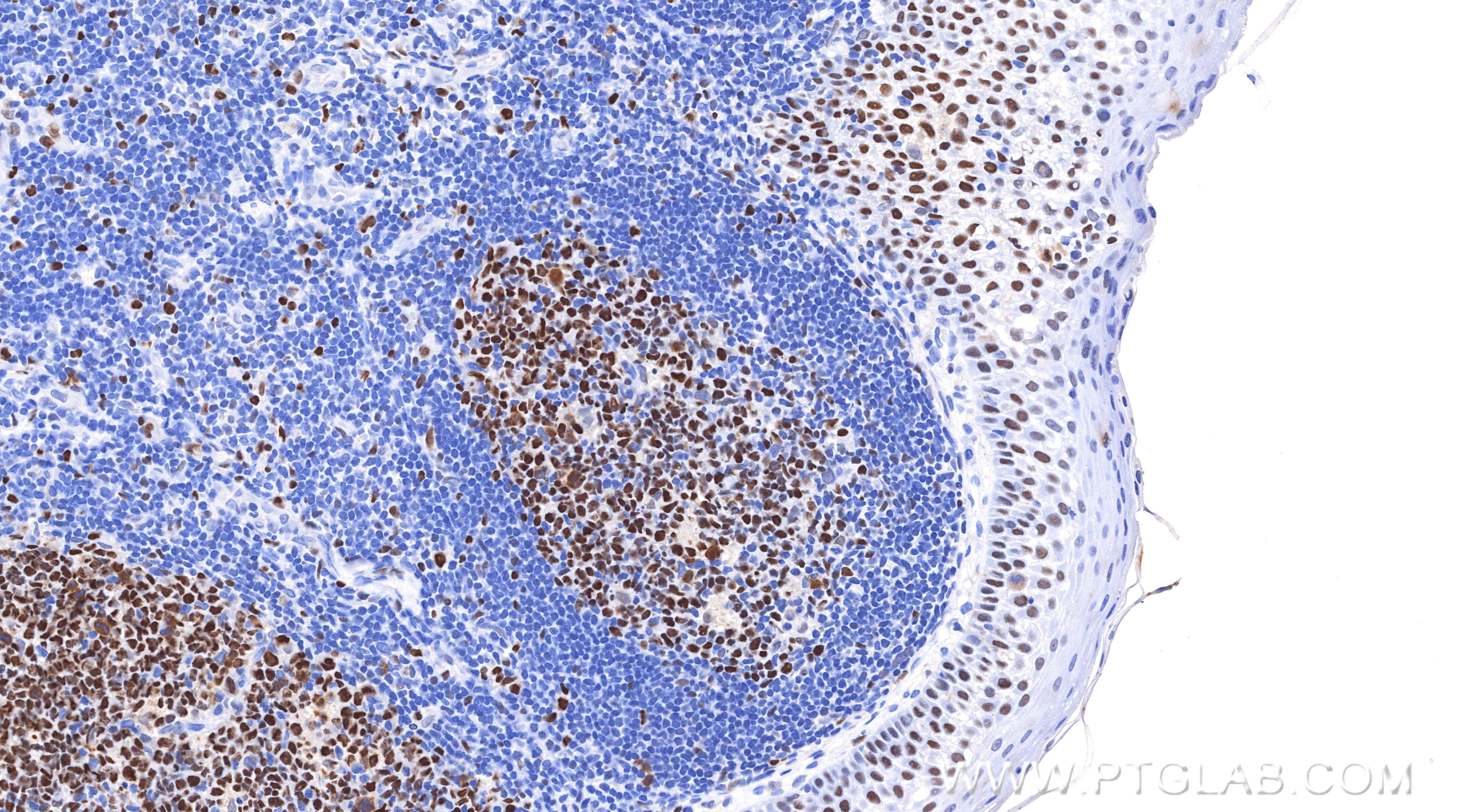 IHC staining of human tonsil using 84511-9-RR (same clone as 84511-9-PBS) Immunohistochemistry (IHC) staining of human tonsil tissue using MCM2 Recombinant monoclonal antibody (84511-9-RR)