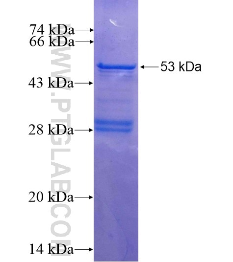 MCM2 fusion protein Ag0798 SDS-PAGE