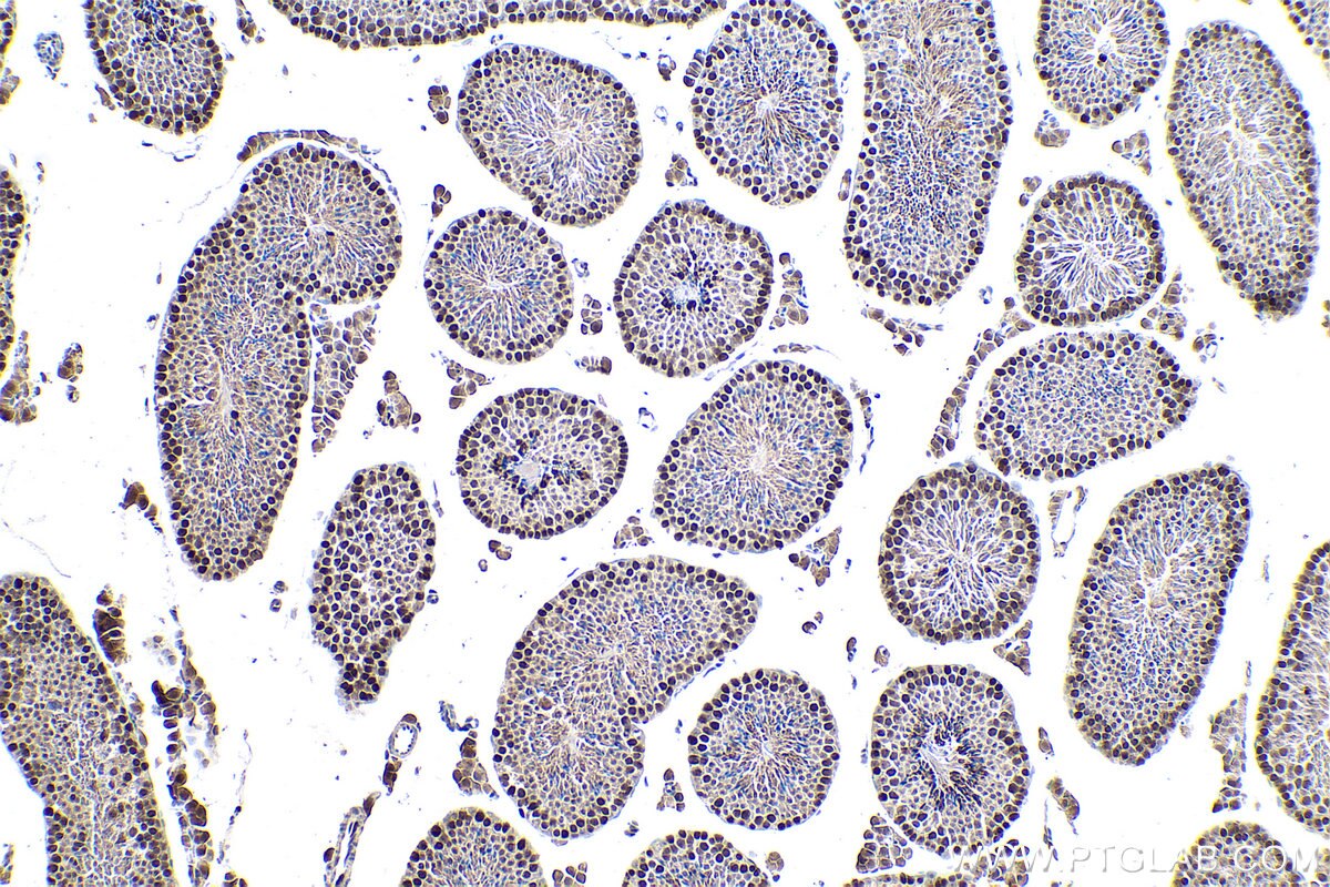 IHC staining of mouse testis using 15597-1-AP Immunohistochemistry (IHC) staining of mouse testis tissue using MCM3 Polyclonal antibody (15597-1-AP)