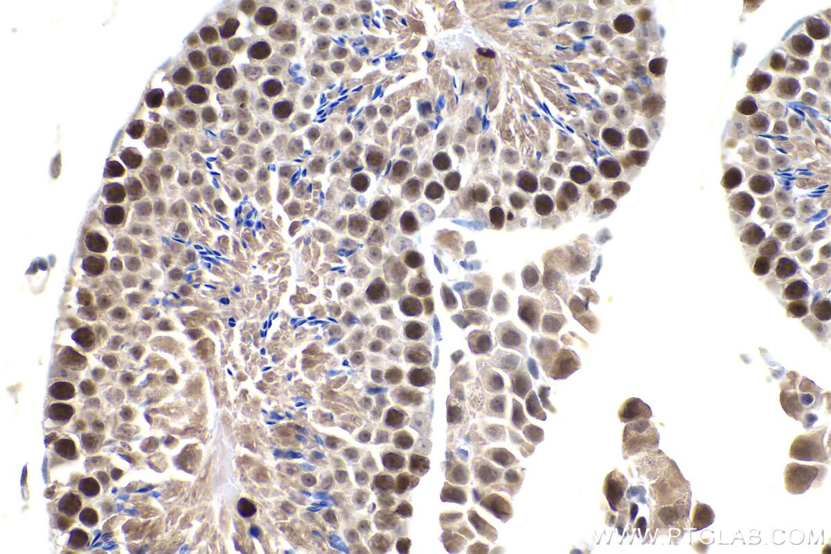 IHC staining of mouse testis using 15597-1-AP Immunohistochemistry (IHC) staining of mouse testis tissue using MCM3 Polyclonal antibody (15597-1-AP)