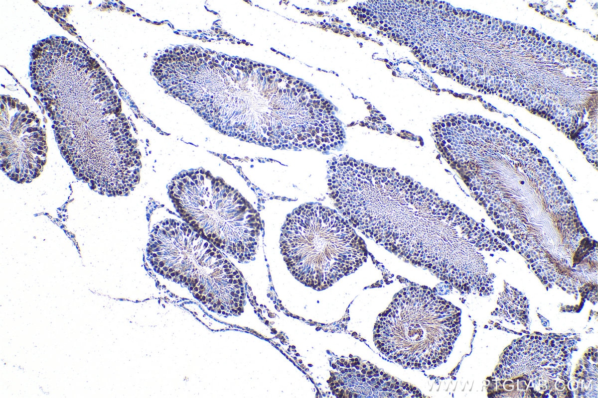 IHC staining of rat testis using 15597-1-AP Immunohistochemistry (IHC) staining of rat testis tissue using MCM3 Polyclonal antibody (15597-1-AP)
