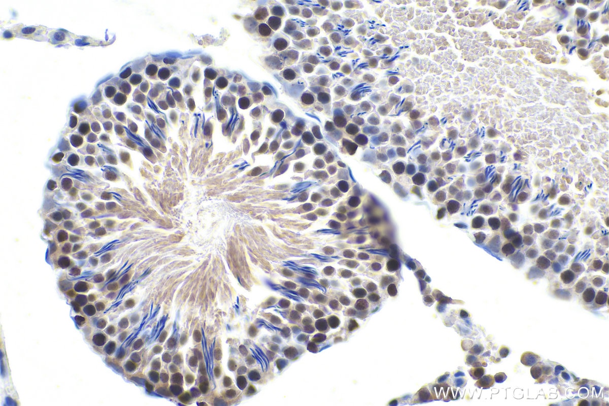 IHC staining of rat testis using 15597-1-AP Immunohistochemistry (IHC) staining of rat testis tissue using MCM3 Polyclonal antibody (15597-1-AP)