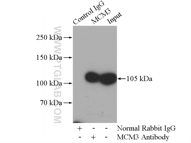Immunoprecipitation (IP) experiment of HeLa cells using MCM3 Polyclonal antibody (15597-1-AP)