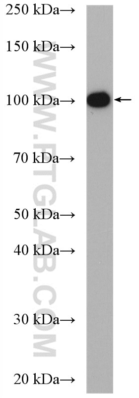 Western Blot (WB) analysis of K-562 cells using MCM3 Polyclonal antibody (15597-1-AP)