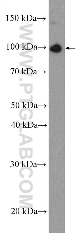 Western Blot (WB) analysis of HeLa cells using MCM3 Polyclonal antibody (15597-1-AP)