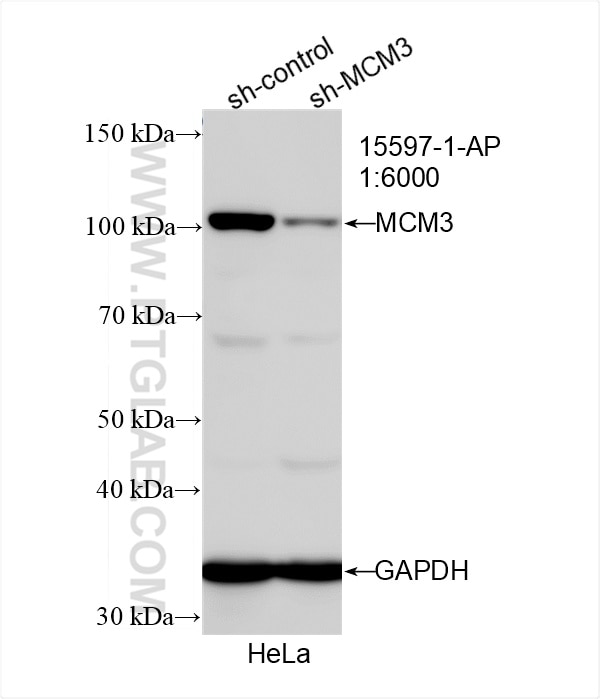 WB analysis of HeLa using 15597-1-AP Western Blot (WB) analysis of HeLa cells using MCM3 Polyclonal antibody (15597-1-AP)