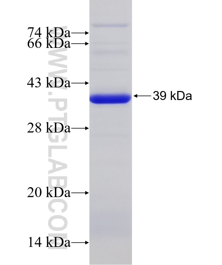 MCM3 fusion protein Ag8122 SDS-PAGE