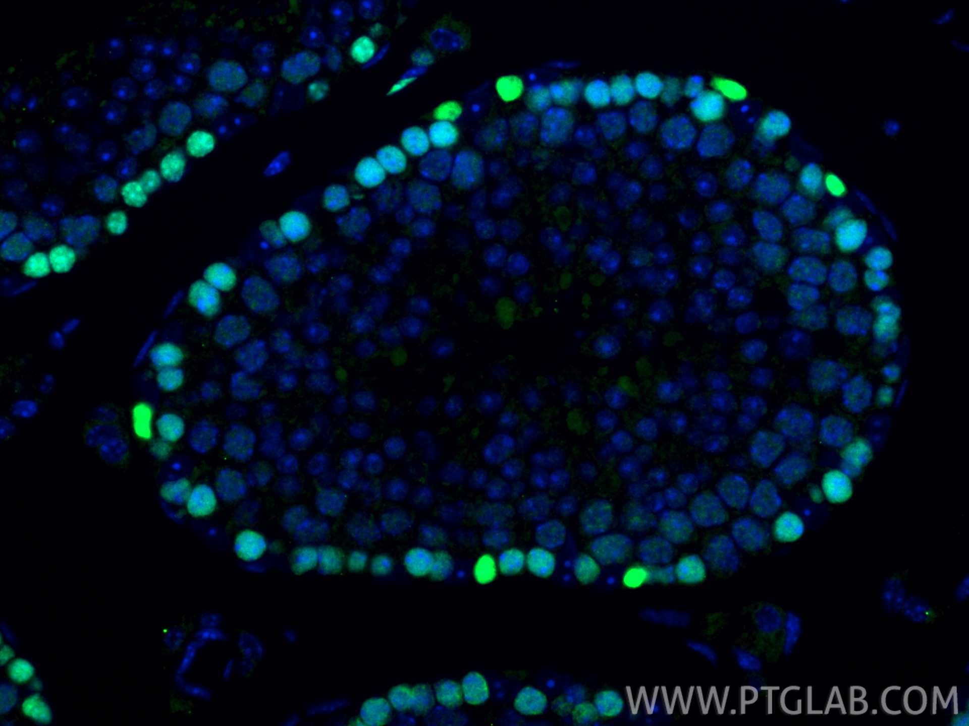 Immunofluorescence (IF) / fluorescent staining of mouse testis tissue using MCM4 Polyclonal antibody (13043-1-AP)