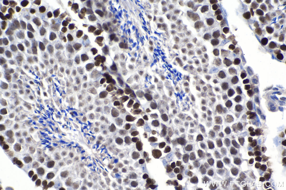 Immunohistochemistry (IHC) staining of mouse testis tissue using MCM4 Polyclonal antibody (13043-1-AP)