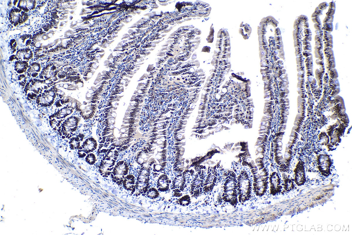 Immunohistochemistry (IHC) staining of rat colon tissue using MCM4 Polyclonal antibody (13043-1-AP)