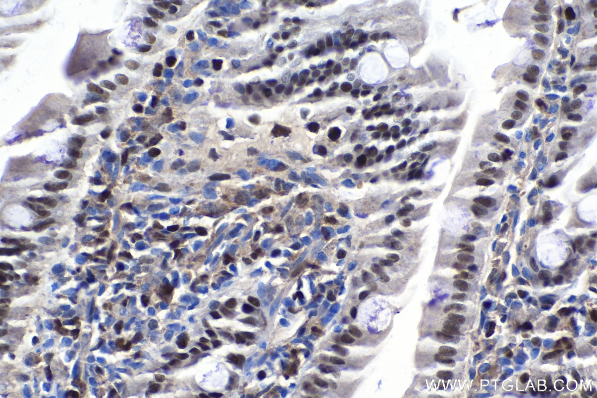 Immunohistochemistry (IHC) staining of rat colon tissue using MCM4 Polyclonal antibody (13043-1-AP)