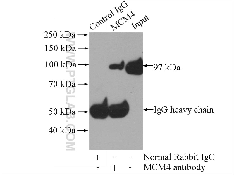 Immunoprecipitation (IP) experiment of HEK-293 cells using MCM4 Polyclonal antibody (13043-1-AP)