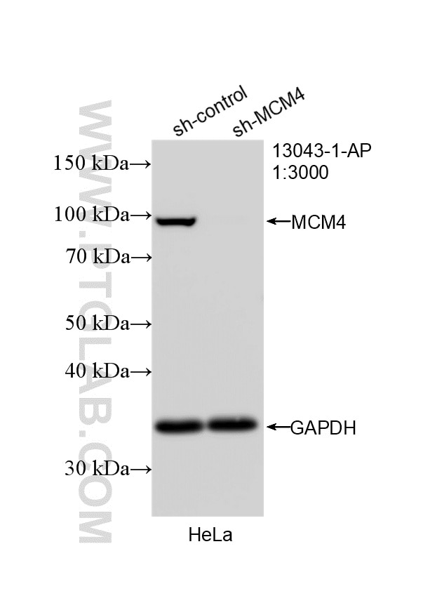 WB analysis of HeLa using 13043-1-AP Western Blot (WB) analysis of HeLa cells using MCM4 Polyclonal antibody (13043-1-AP)