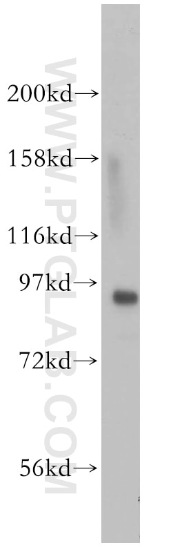 Western Blot (WB) analysis of HeLa cells using MCM4 Polyclonal antibody (13043-1-AP)