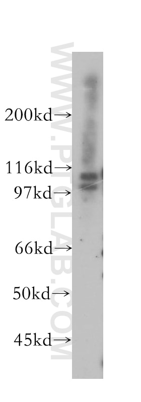 Western Blot (WB) analysis of human liver tissue using MCM4 Polyclonal antibody (13043-1-AP)