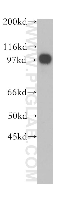 Western Blot (WB) analysis of HEK-293 cells using MCM4 Polyclonal antibody (13043-1-AP)