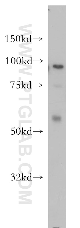 Western Blot (WB) analysis of HL-60 cells using MCM4 Polyclonal antibody (13043-1-AP)