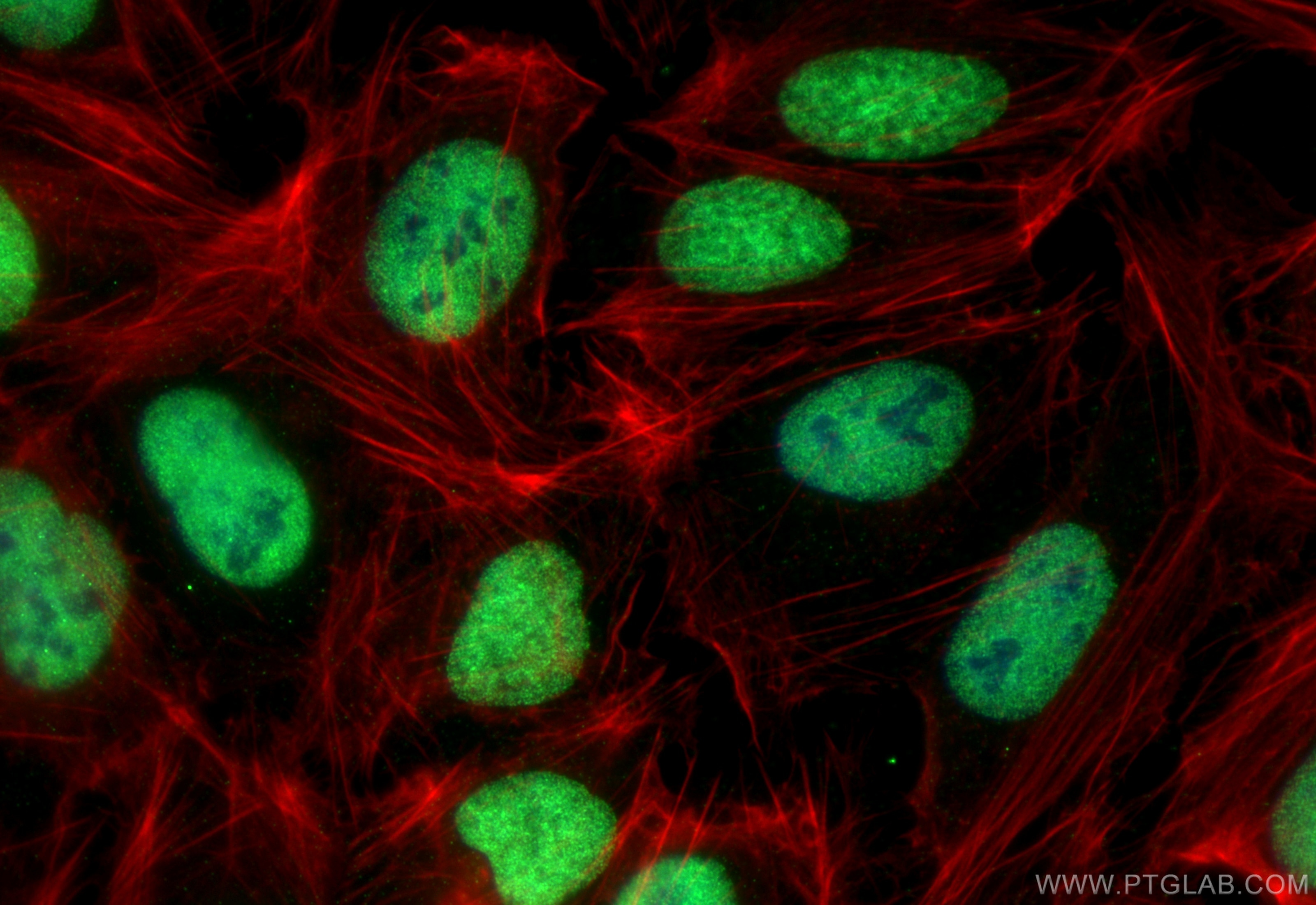 Immunofluorescence (IF) / fluorescent staining of U2OS cells using MCM4 Monoclonal antibody (67103-1-Ig)