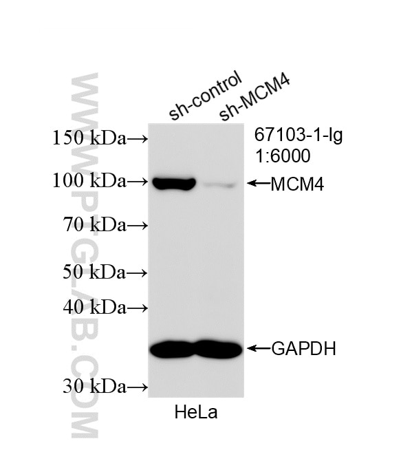 Western Blot (WB) analysis of HeLa cells using MCM4 Monoclonal antibody (67103-1-Ig)