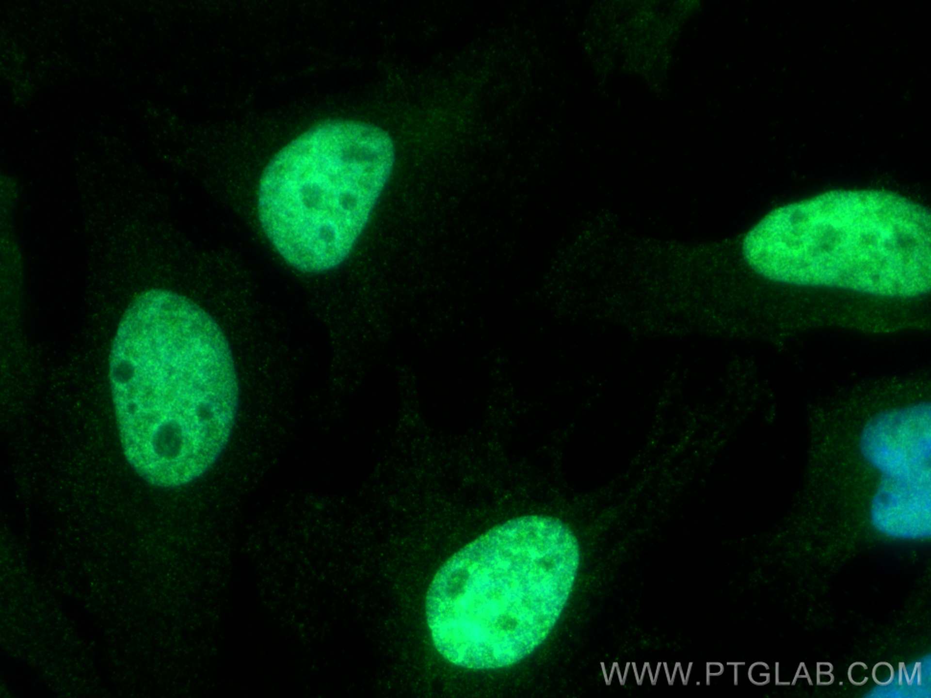 Immunofluorescence (IF) / fluorescent staining of HeLa cells using MCM5 Polyclonal antibody (11703-1-AP)