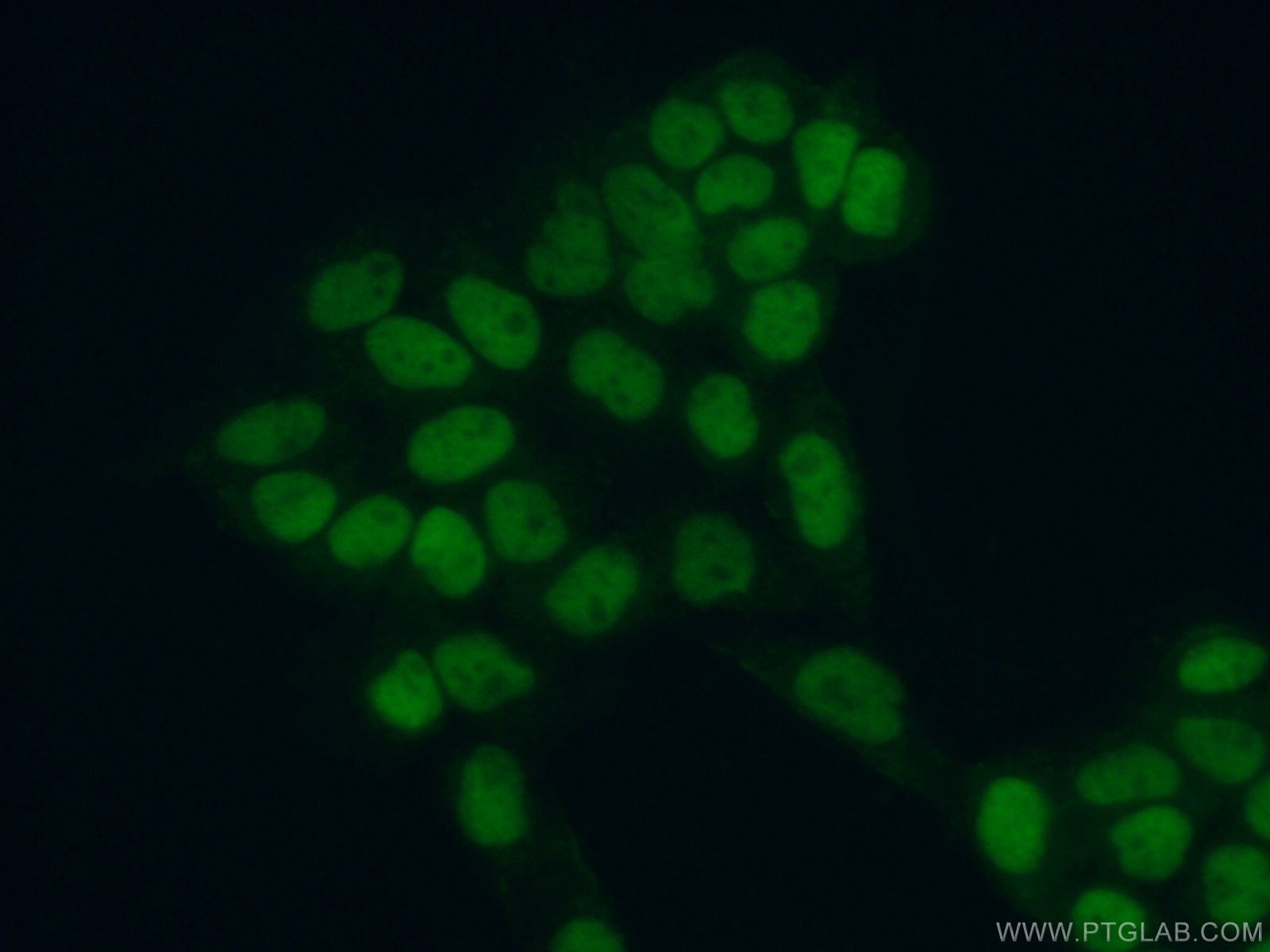 Immunofluorescence (IF) / fluorescent staining of HeLa cells using MCM5 Polyclonal antibody (11703-1-AP)