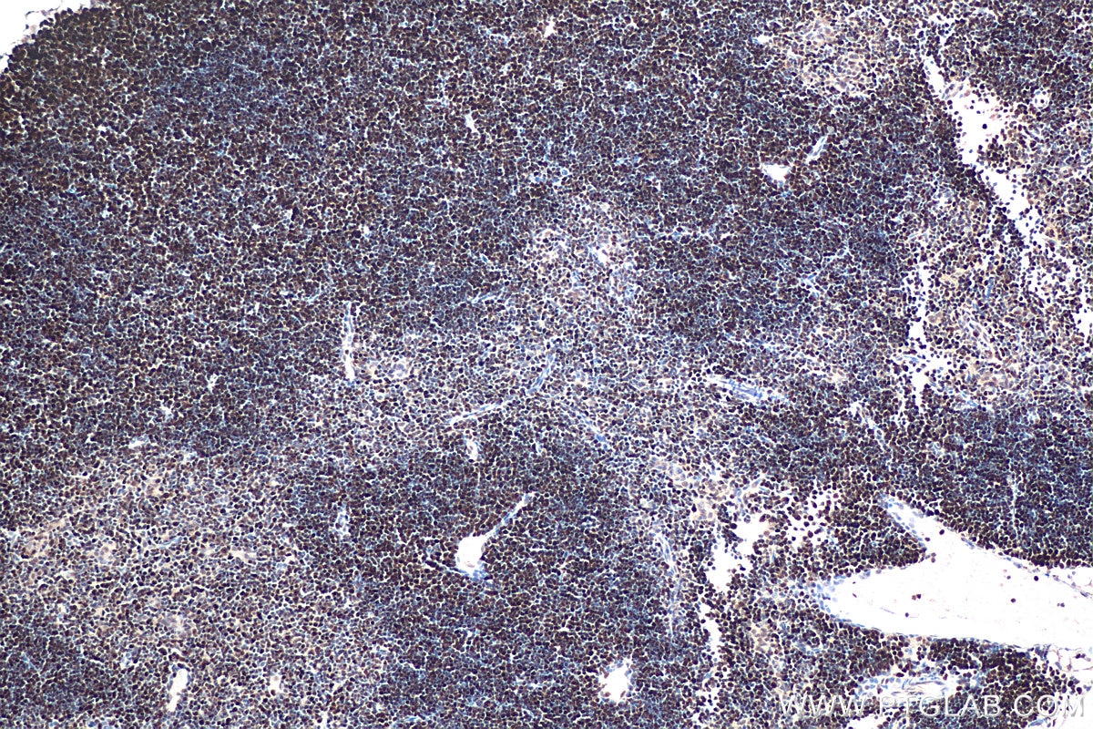 Immunohistochemistry (IHC) staining of mouse thymus tissue using MCM5 Polyclonal antibody (11703-1-AP)