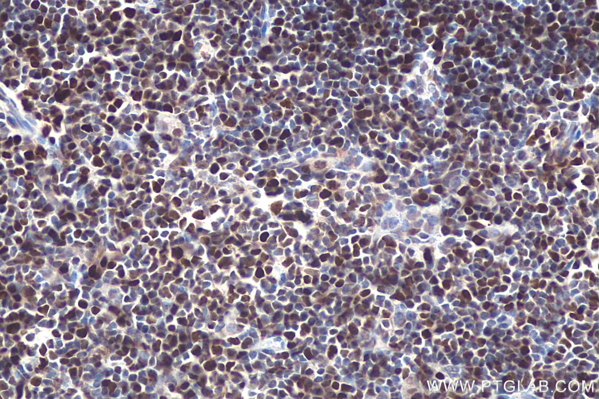 Immunohistochemistry (IHC) staining of mouse thymus tissue using MCM5 Polyclonal antibody (11703-1-AP)