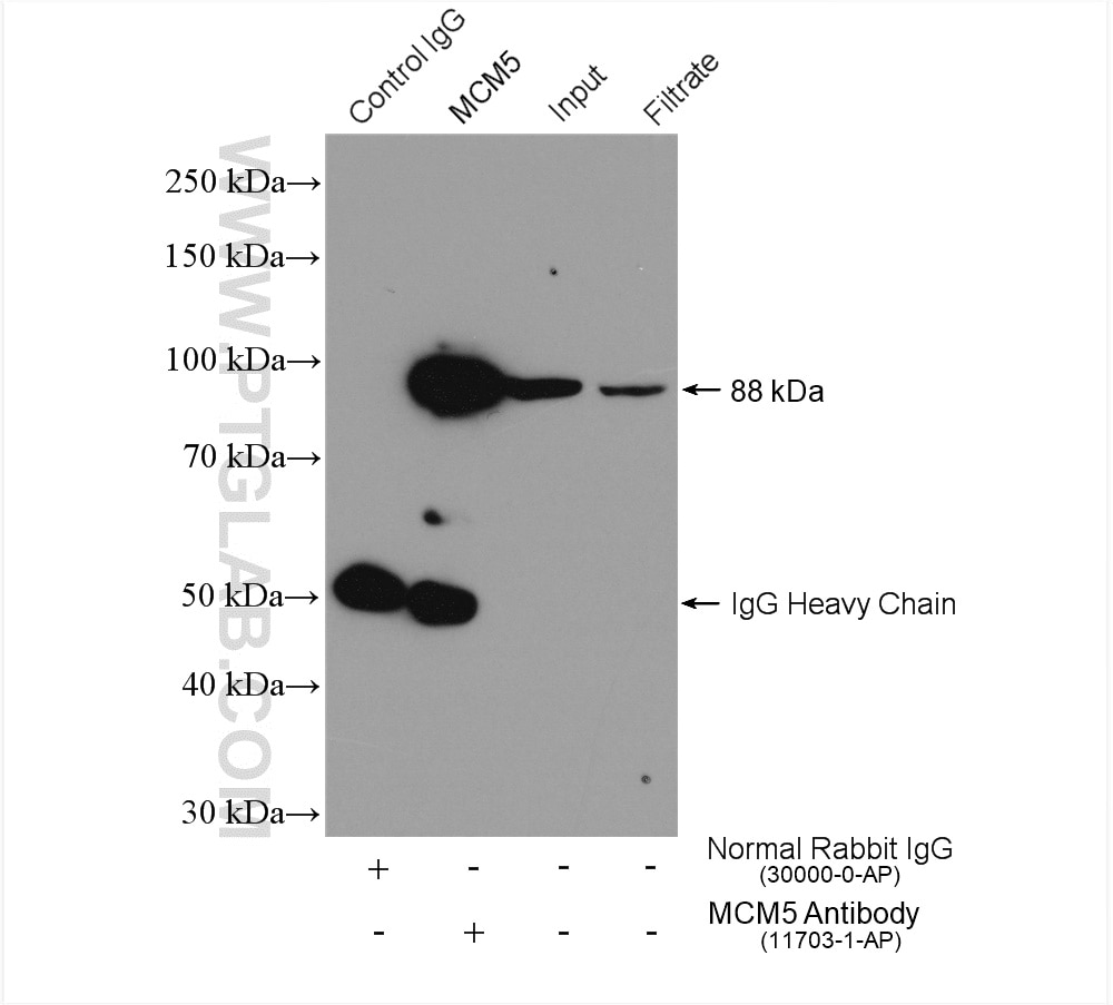 Immunoprecipitation (IP) experiment of Jurkat cells using MCM5 Polyclonal antibody (11703-1-AP)