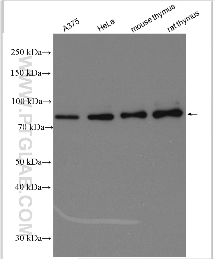 Western Blot (WB) analysis of various lysates using MCM5 Polyclonal antibody (11703-1-AP)