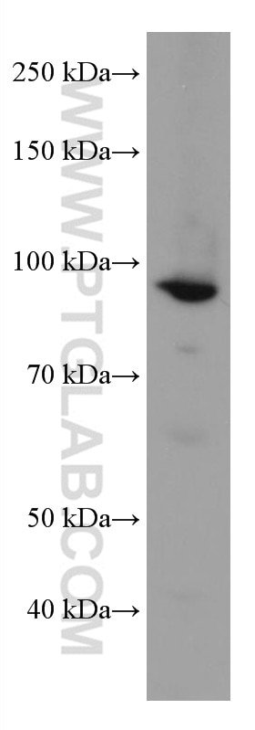 Western Blot (WB) analysis of HeLa cells using MCM5 Monoclonal antibody (67049-1-Ig)