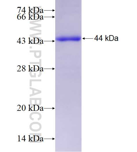 MCM5 fusion protein Ag28704 SDS-PAGE