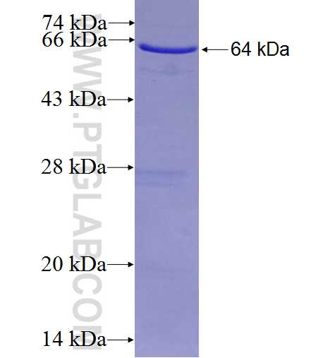 MCM5 fusion protein Ag2271 SDS-PAGE