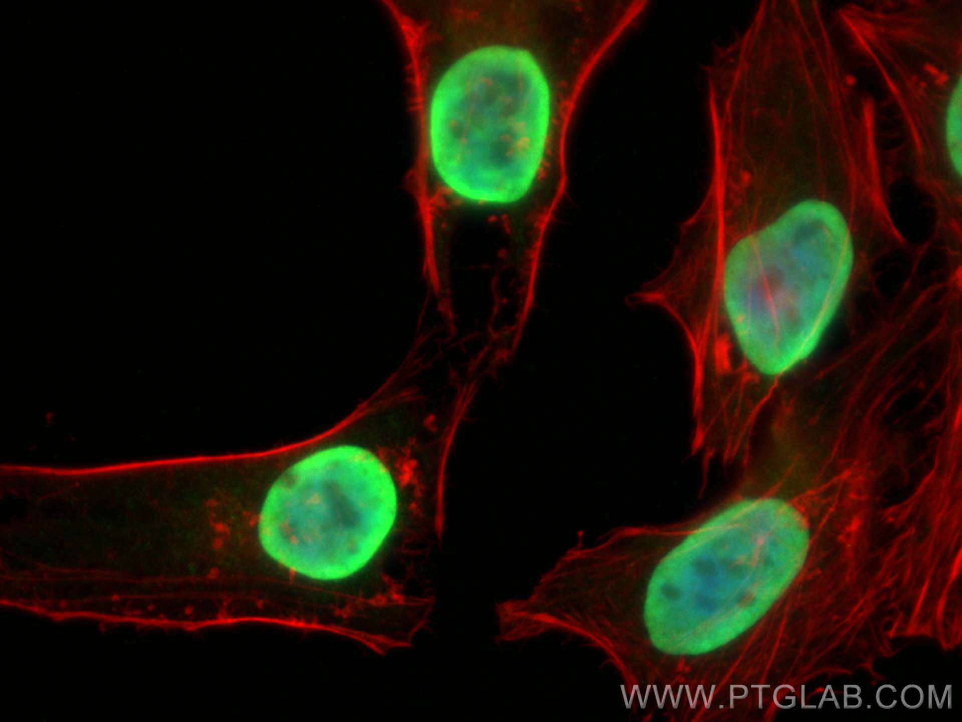 Immunofluorescence (IF) / fluorescent staining of HeLa cells using MCM6 Polyclonal antibody (13347-2-AP)
