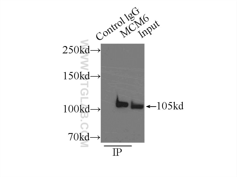 Immunoprecipitation (IP) experiment of HeLa cells using MCM6 Polyclonal antibody (13347-2-AP)