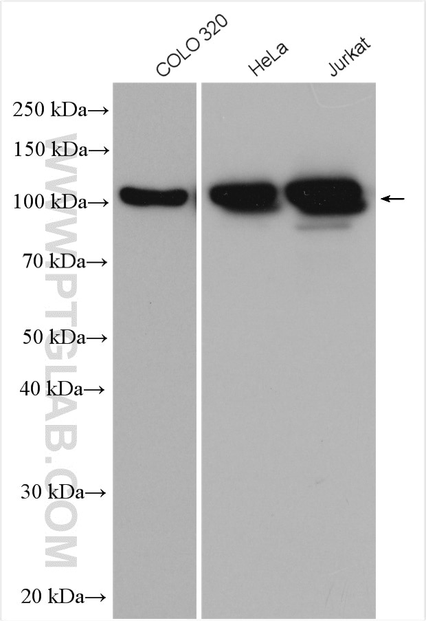 Western Blot (WB) analysis of various lysates using MCM6 Polyclonal antibody (13347-2-AP)