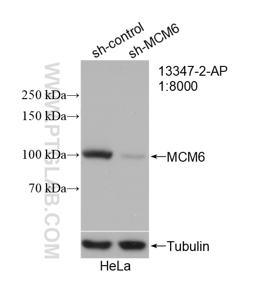 Western Blot (WB) analysis of HeLa cells using MCM6 Polyclonal antibody (13347-2-AP)